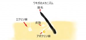 ワキガ解説